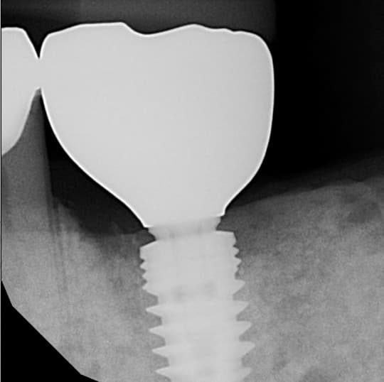 Restorative Dentistry